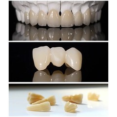 C14 Dental Lithium Disilicate Glass-ceramic Blocks HT/LT Emax Chairside CAD/CAM
