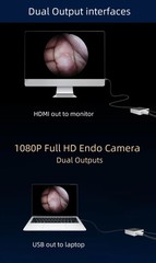 Portable Endoscopy ENT Camera surgery FHD Surgical Camera Endoscope Arthroscopy