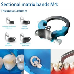 Dental Matrix Bands Clamp Ring Palodent V3 Sectional Matrix System Wedges Pliers