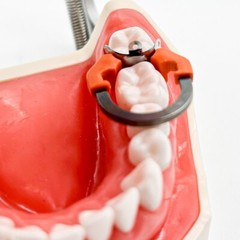 Dental Matrix Bands Ring Sectional Matrice Clamp Fit Garrison Palodent V3 System