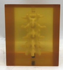 Hologic DPA/QDR-1 Bone Densitometer Anthropomorphic Spine Phantom 030-1967