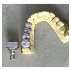 US Dental C14 HT/LT Emax Glass Ceramic Blocks Lithium Disilicate CAD/CAM CEREC