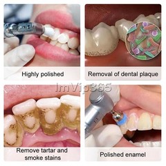 Dental Prophy Paste Prophylaxis Tooth Polish Stain Remover Unit Dose