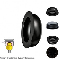 US Dental ZEST Locator Standard Extended Range Male Cap Black Processing Inserts