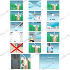 Dental Glass Fiber Post Endo Drill Root Canal Posts Fits 3M 3D ESPE RelyX