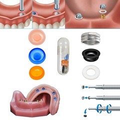 US Fit Straumann Analog Scan Body Transfer Healing Abutment Cap ITI Bone Level