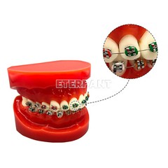 ETERFANT 1040PCs Dental Ortho Elastic Ligature Ties Rubber Bands/Buccal Tubes