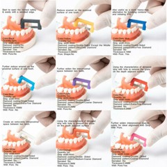 Orthodontic IPR/IR Strips Dental Interproximal Reduction Enamel stripping saws